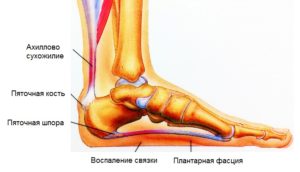 Как уменьшить боль в пятке правой ноги