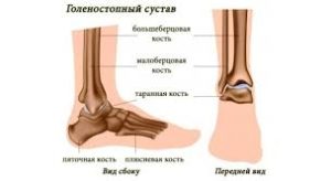 Перелом ноги в голеностопе: симптоматика, признаки