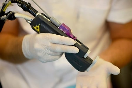 Неодимовый лазер в руках врача